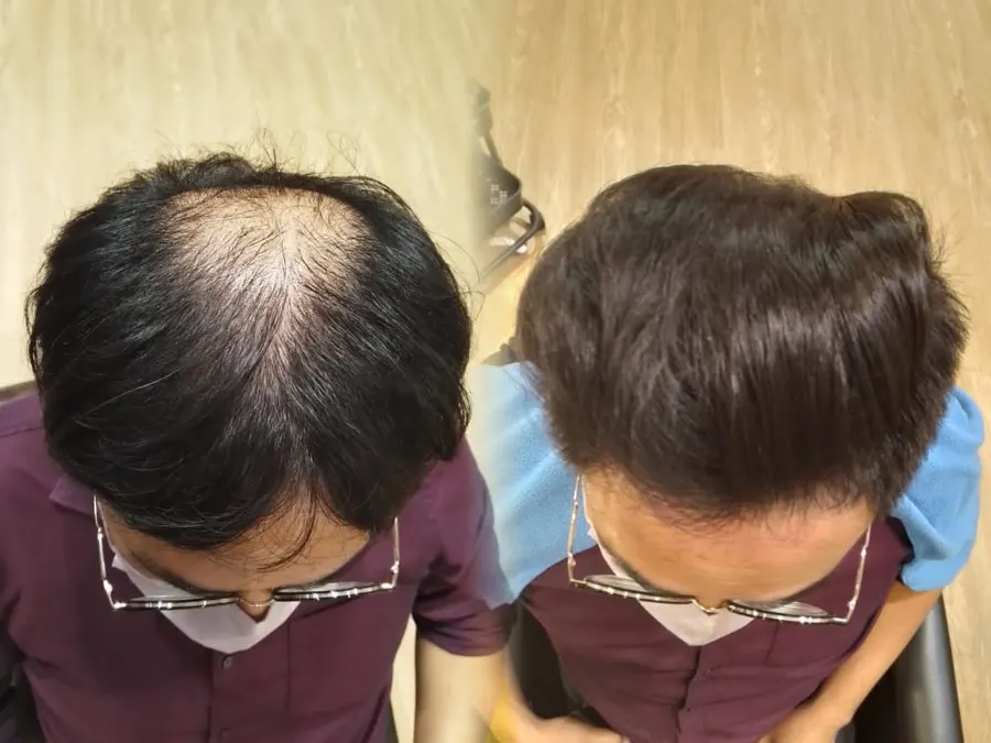Before and after 1 session, photo 6